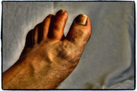 Foot Foot