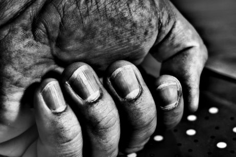 Dirty Hand and Nails Dirty Hand and Nails