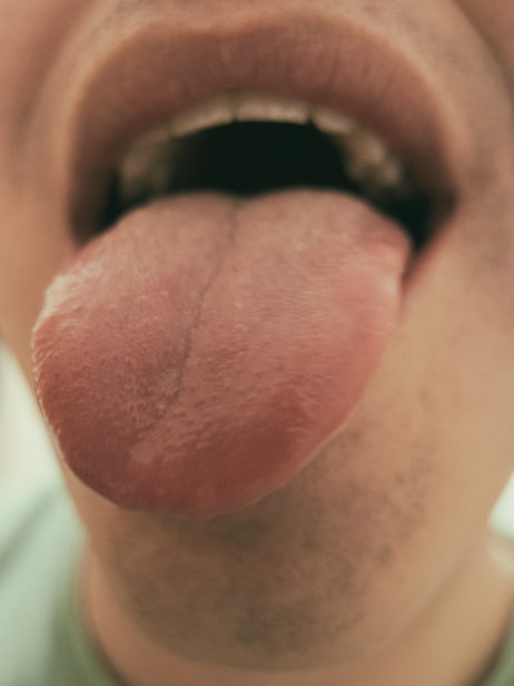 Tongue Out Tongue Out
