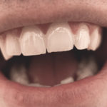 Mouth And Teeth Close Up