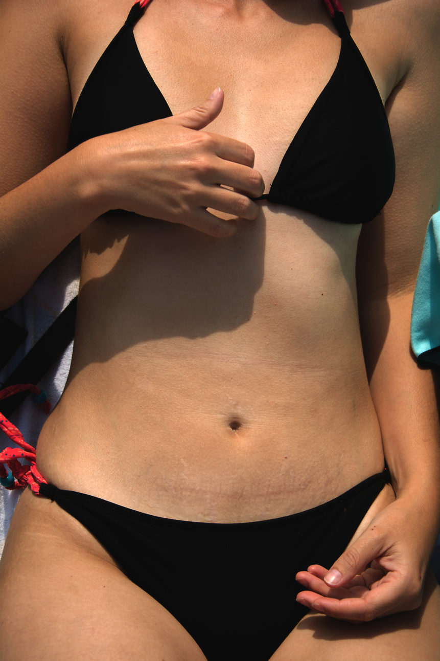 woman body black bikini